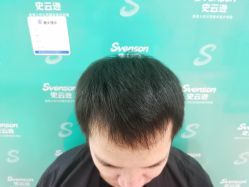 点击看大图 -雍禾植发全国连锁