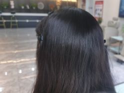 -碧莲盛·不剃发植发