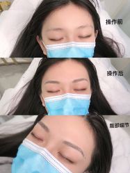 -久匠半永久纹眉