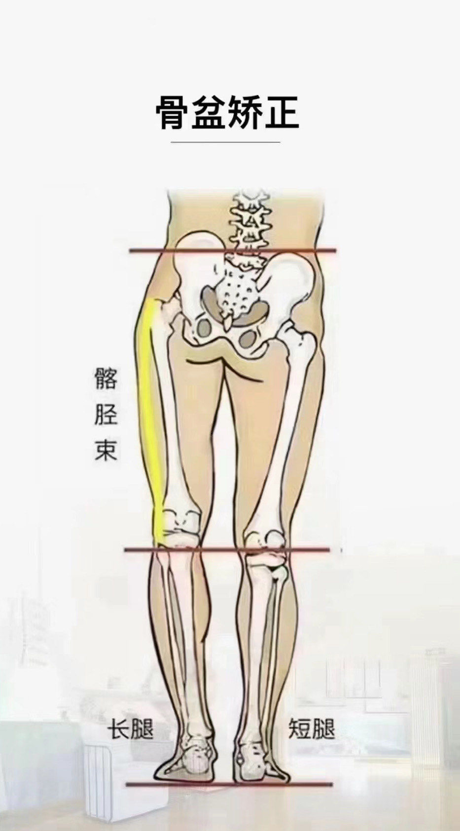 骨盆闭合修复是每一位妈妈的必修课