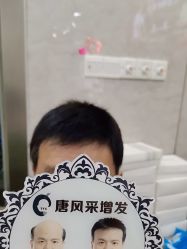 -唐风采假发补发定制