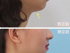 -柏乐口腔(南宁总院)