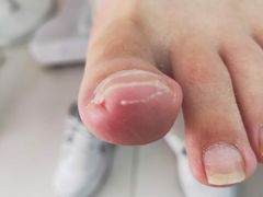 -新甲连锁灰指甲·甲沟炎·鸡眼(黑龙江路店)