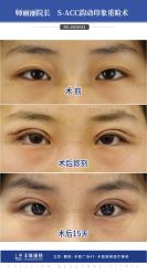 -丰联丽格医疗美容·联合丽格眼整形中心
