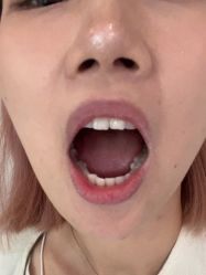 -瑞丽口腔·美学矫正中心