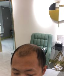 -发饰美男士增发补发假发定制店