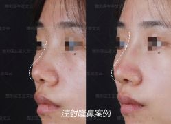 -北京米扬丽格医疗美容·联合丽格鼻整形中心