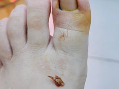 -新甲连锁灰指甲·甲沟炎·鸡眼(黑龙江路店)