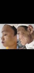 -痘敏医生专业祛痘·肌肤修复连锁