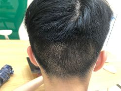 -雍禾植发全国连锁