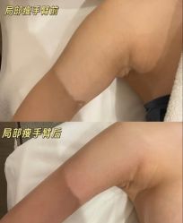 -Fundi张玉珊修身堂·indiba·BTL科技瘦身