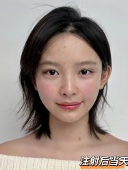 -Yestar重庆艺星医疗美容医院