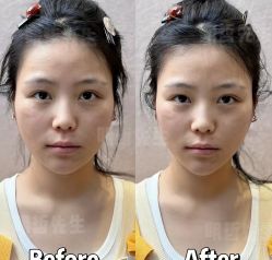 -颜和骨正&明星徒手小颜整骨