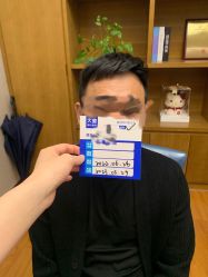 体验后-大麦微针植发全国连锁