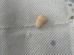 -深圳美澳口腔·种植修复中心