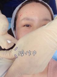 -亿美医疗美容·半岛大超炮官方授权店
