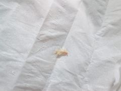 -世龙世家灰指甲鸡眼脚气甲沟炎跖疣护理(通州店)