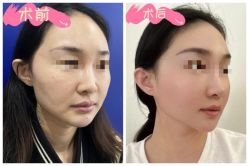 -素美医疗美容·西南眼鼻整形·修复基地