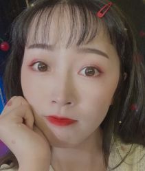 -大麦微针植发全国连锁