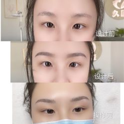 -久匠半永久纹眉