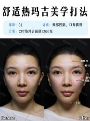 -深圳艺星医疗美容医院