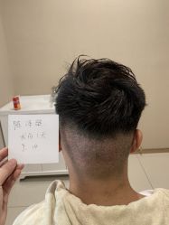 -大麦微针植发丨全国连锁