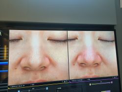 -苑苑vbeauty科技美容SPA