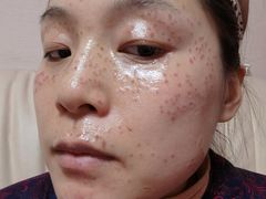 -杭州市第三人民医院