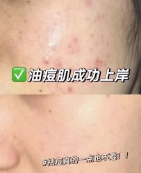 -SKIN79皮肤管理中心