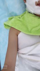 -苗医生0感科技祛痘