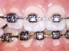 -方津口腔(旺墩路店)