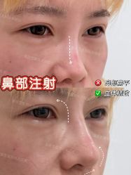 -Yestar重庆艺星医疗美容医院