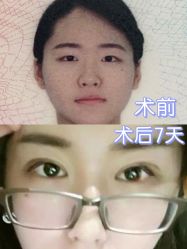 -上海玫瑰医疗美容医院