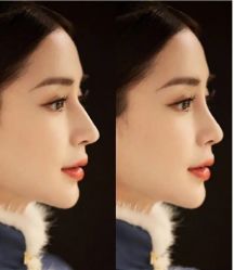 -上海漾颜医疗美容