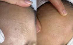 -康美贞·痘肌养护管理中心