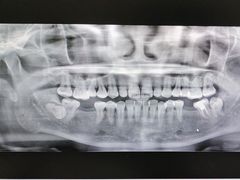 -土豆口腔(凤凰北总店)