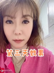 体验后-沈阳名流美容医院