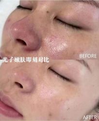 -南宁维密整形·王敦华眼鼻整复中心