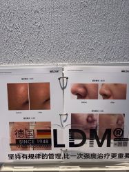 -小梨·OndaPro·专业脱毛连锁机构