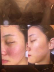点击看大图 -东森自然美.INDIBA.美容SPA.皮肤管理