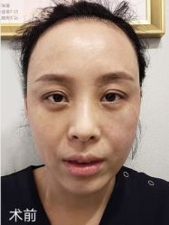 点击看大图 体验前-脸博士医疗美容·眼鼻整形·抗衰中心