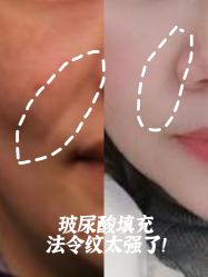 -广州美莱医疗美容医院