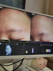 -苑苑vbeauty科技美容SPA