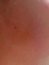 点击看大图 体验后-BR光电保养