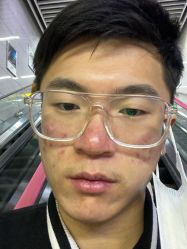 体验后-重庆联合丽格第五医疗美容医院
