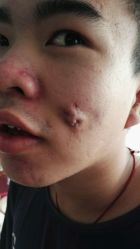 点击看大图 -痘博士广州·全国连锁祛痘机构