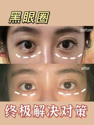 -厦门美莱整形美容医院