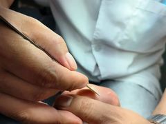 -新甲连锁灰指甲·甲沟炎·鸡眼(黑龙江路店)