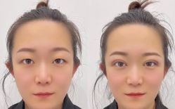 -郡艺医疗美容·微整·眼鼻吸脂