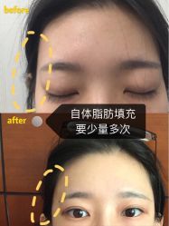 -成都大华医学美容医院